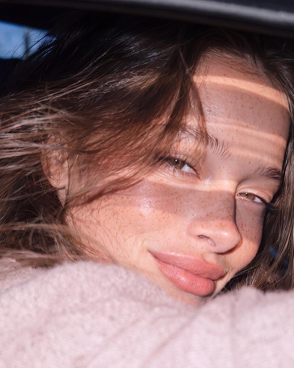 Freckles in sunlight, close-up